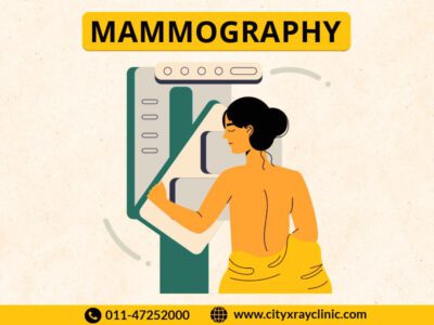 Mammography Scan Near Me In Delhi At Reasonable Price